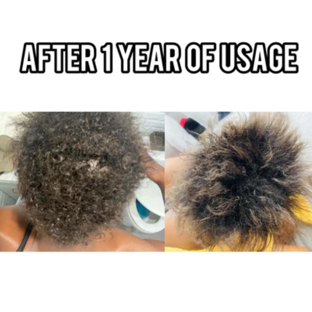 Grow Thicker, Stronger Hair Bundle | Fast Hair Growth